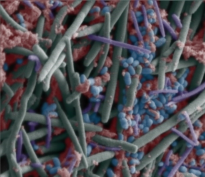 전자현미경으로 관찰한 잇몸주머니 속 생물막에 인위적으로 색을 입힌 사진. 구균과 간균, 나선균 등 다양한 세균이 엉겨있다. 위키미디아 제공