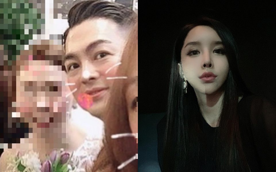 미키정, 하리수