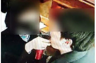 코로나19 대규모 확진 사태가 발생한 경기 성남 은혜의강교회에서 예배에 참석한 사람들 입에 분무기로 소금물을 뿌리는 장면. 참석자들 입에 분무기로 뿌린 소금물이 감염 확산의 주원인이라는 지적이 나왔다.경기도 제공