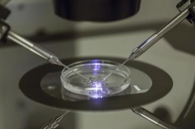 체외수정 자료사진, 출처: 연합뉴스