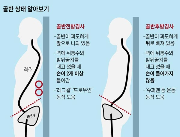 전방경사, 후방경사/사진 제공=김하경
