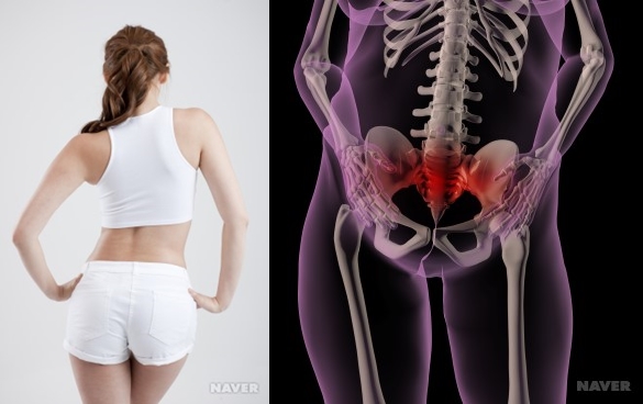 허리틀어짐/사진 제공=naver지식백과