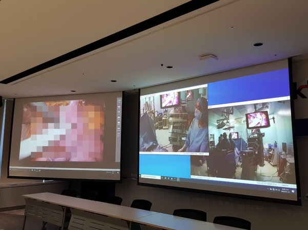 5G 네트워크를 통한 실제 수술실을 중계하는 모습. /이경탁 기자
