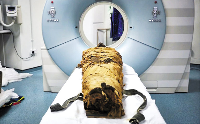 기원전 11세기에 살았던 고대 이집트 사제 ‘네시아문(Nesyamun)’의 미라를 컴퓨터단층촬영(CT)하는 모습. 연구진은 미라의 발성기관 CT를 바탕으로 네시아문의 생전 목소리를 복원했다. /사이언티픽 리포트