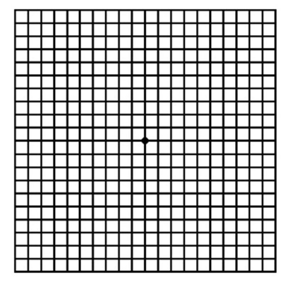 암슬러 격자 테스트