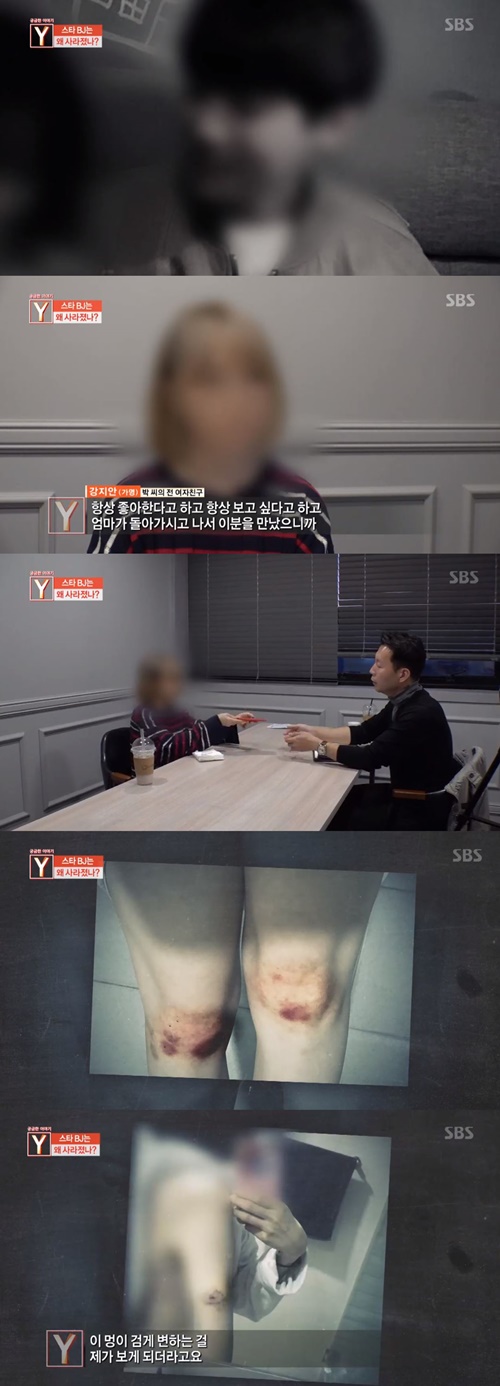 ‘궁금한 이야기Y’ 스타BJ 박씨의 전 여자친구가 그의 폭력을 증언했다. 사진=SBS ‘궁금한 이야기Y’ 캡처