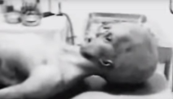 1995년 공개된 로즈웰 외계인 시체 해부 영상. 후에 조작이라고 밝혀졌다. [사진 유튜브 mysterydatabase 계정 캡처]