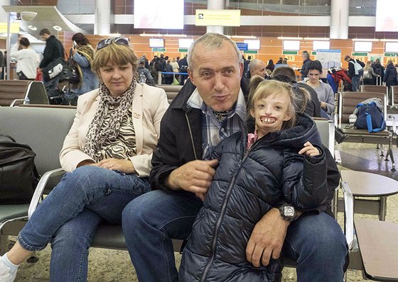기적같은 아래턱 형성수술 덕분에 웃음을 되찾게 된 러시아의 안면기형 소녀 다리나 슈펜글러(오른쪽). 3개월 만에 모스크바 공항에서 해후한 아빠 유리(가운데)는 "정말 예쁜 내 딸"이라며 기쁨을 감추지 못했다. 엄마 엘레나(왼쪽)는 "많은 이들의 도움과 격려 덕분에 다리나가 웃게 됐다"고 말했다. [시베리안 타임스 캡처]