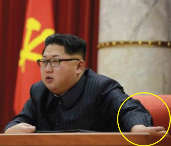 2016년 1월 13일 공개된 김정은 북한 국무위원장의 비정상적으로 뒤틀린 왼손 모습. [노동신문]