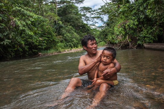 선천적 척추 기형을 앓고 있는 윌슨과 아빠. 아빠가 씻겨주는 대로 얌전히 아빠에게 안겨 있는 아이의 모습이 인상적이었다. 등에서 전해져 오는 온기로 아빠 품에서 느끼는 아마존의 대자연은 따뜻하지 않을까.