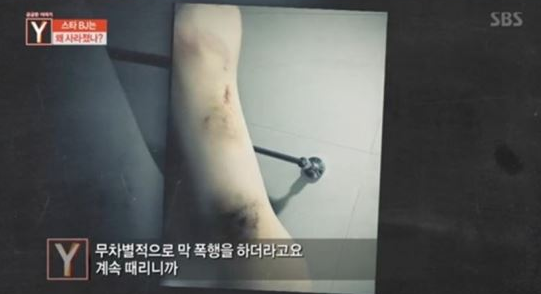 사진=SBS 궁금한이야기Y 방송 캡처