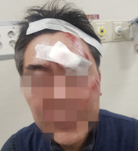 지난 22일 더불어민주당 소속 강북구의원 최재성(40)씨에게 폭행 당한 동장 조모(59)씨. /뉴시스