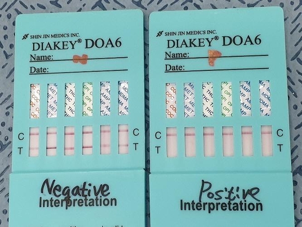 총 6가지 마약 성분을 검출할 수 있는 마약 검출기. 각 칸에 붉은색 한 줄이 뜨면 양성(오른쪽), 두 줄이 뜨면 음성을 뜻한다. /박주연 인턴기자