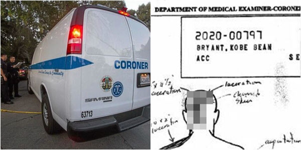 LA 카운티 검시 사무소 차량(왼쪽)과 유출된 코비의 부검 보고서 중 일부./LA 카운티 검시 사무소