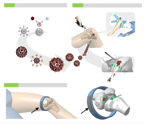 줄기세포 탑재 마이크로 로봇 이용한 무릎 연골 재생 과정[한국마이크로의료로봇연구원 제공. 재판매 및 DB 금지]