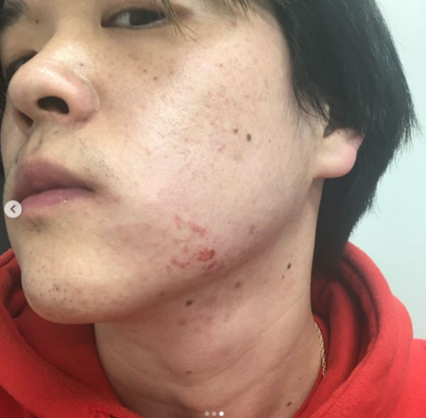 출처: 킹치메인 인스타그램