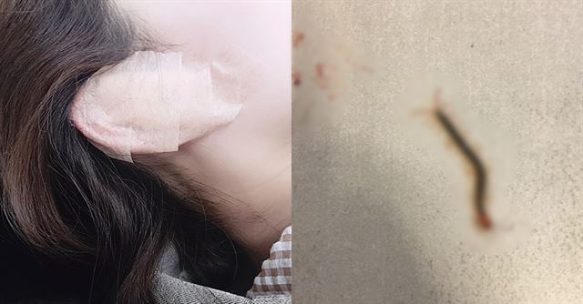 숙박객 A씨가 지방에 있는 숙박시설에 머물다 귀에 지네가 들어갔다고 주장하며 관련 사진과 영상 등을 17일 블로그를 통해 공개했다. A씨 블로그 캡처