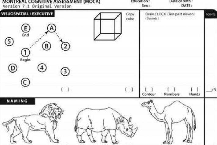 몬트리올 인지평가 문항 일부. (사진=연합뉴스)