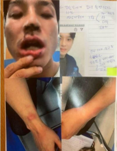 김씨가 자신의 인스타그램 및 온라인 커뮤니티에 버닝썬 직원과 경찰 폭행을 주장하며 직접 올린 사진.