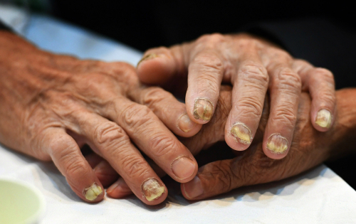 2018년 8월 25일 오후 단체상봉이 진행된 금강산 이산가족면회소에서 북측의 박영환(85) 할아버지가 우리측 누나 박봉임(89) 할머니와 손을 꼭 잡고 다가오는 작별의 시간을 준비하고 있는 모습. 금강산=사진공동취재단