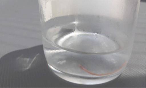 부산 지역 수돗물에서 발견된 실지렁이. 부산시 상수도사업본부