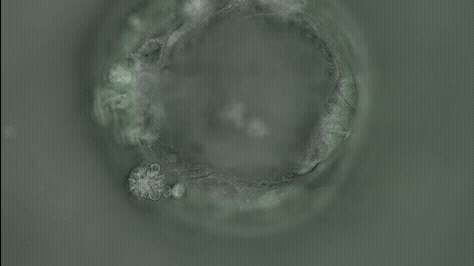 박쥐 오가노이드가 바이러스에 감염됐을 때의 변화. [사진=IBS]
