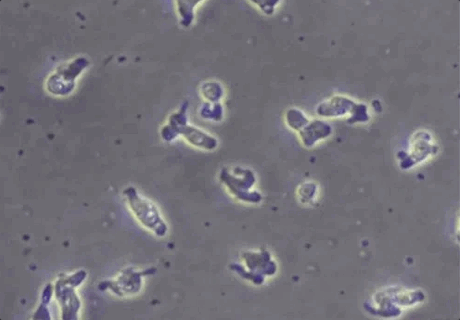 뇌를 파 먹는 아메바로 알려진 파울러자유아메바. 미국 질병통제예방센터(CDC)