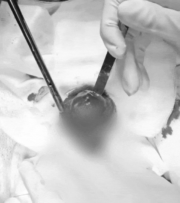 방광 결석 수술 제거 장면(광주 스카이동물메디컬센터 제공) ⓒ 뉴스1