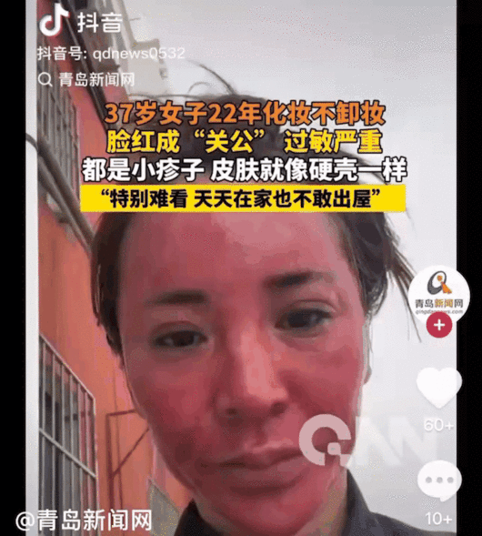 [서울=뉴시스]최근 중국 온라인 커뮤니티를 통해 22년간 화장을 제대로 지우지 않았다는 37세 여성 A씨의 사연이 전해지며 누리꾼들의 충격을 자아냈다.(사진=好看??) *재판매 및 DB 금지